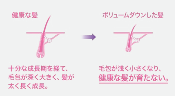 健康な髪とボリュームダウンした髪