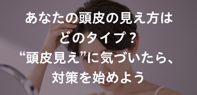 あなたの頭皮の見え方はどのタイプ？ “頭皮見え”に気づいたら、対策を始めよう